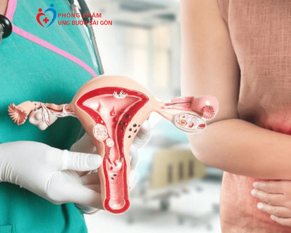 ung thư cổ tử cung